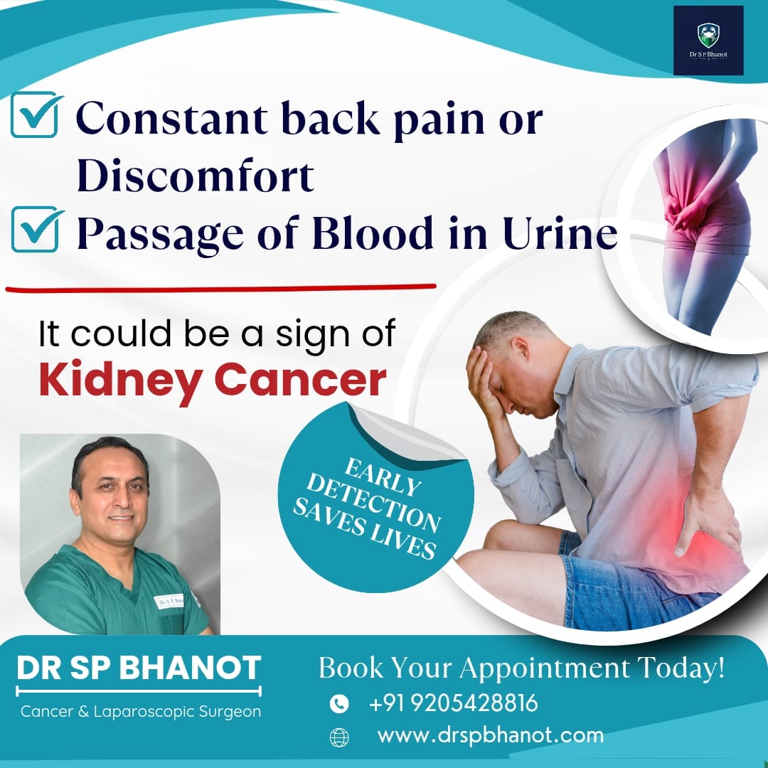 kidney cancer
